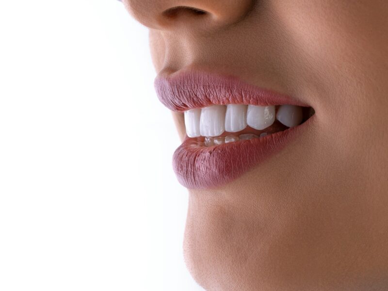 a close up of a woman's mouth with white teeth